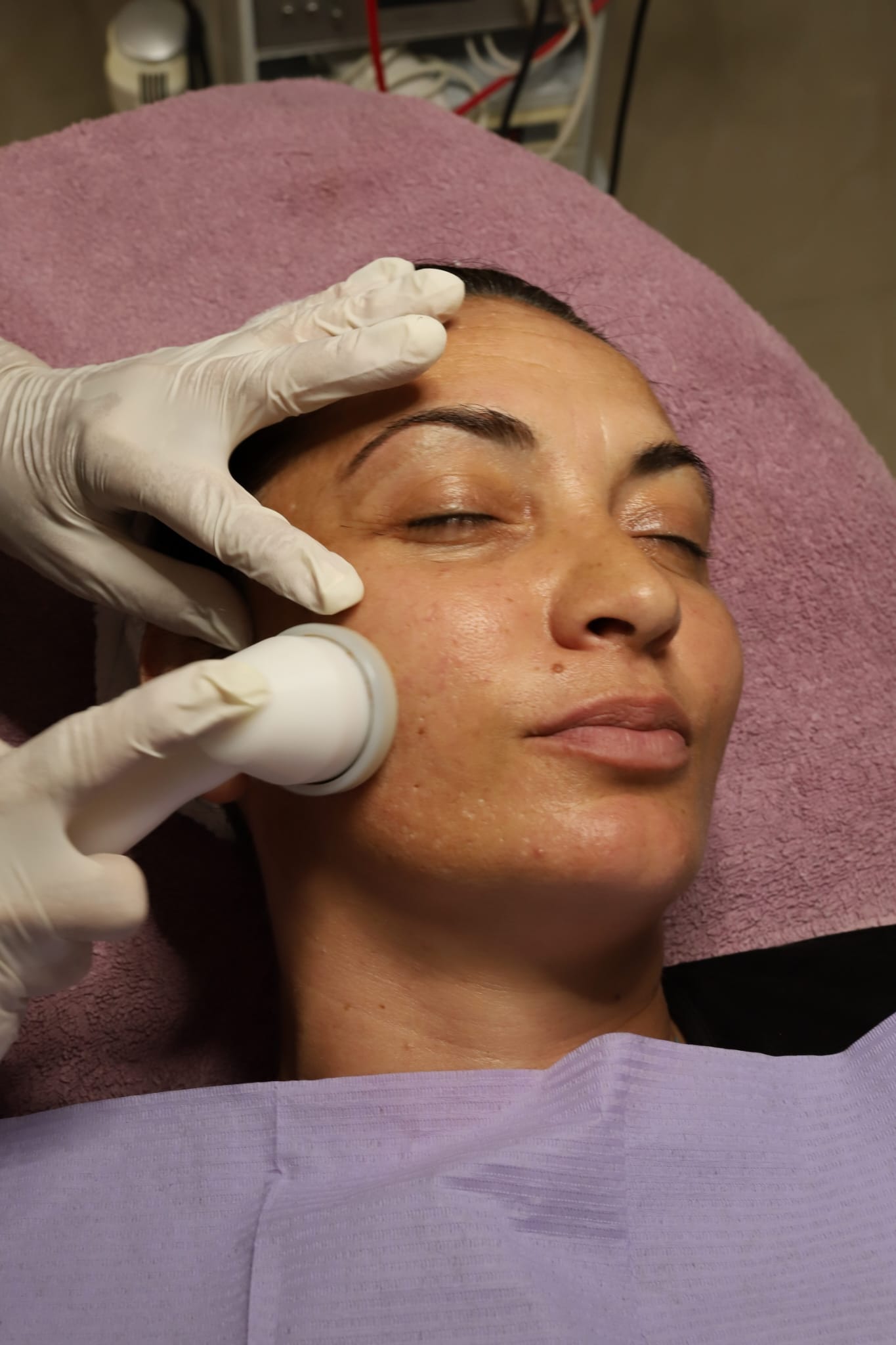 Depilacije lica i tijela